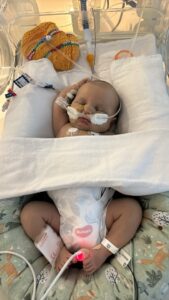 Baby Mitch at Monash Childrens Hospital