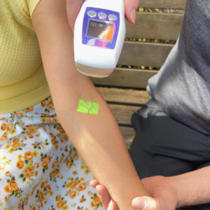 Handheld device scanning forearm, displaying green vein pattern for medical visualisation.