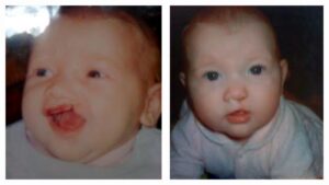 Two close-up photos of an infant wearing white clothing, shown side by side.